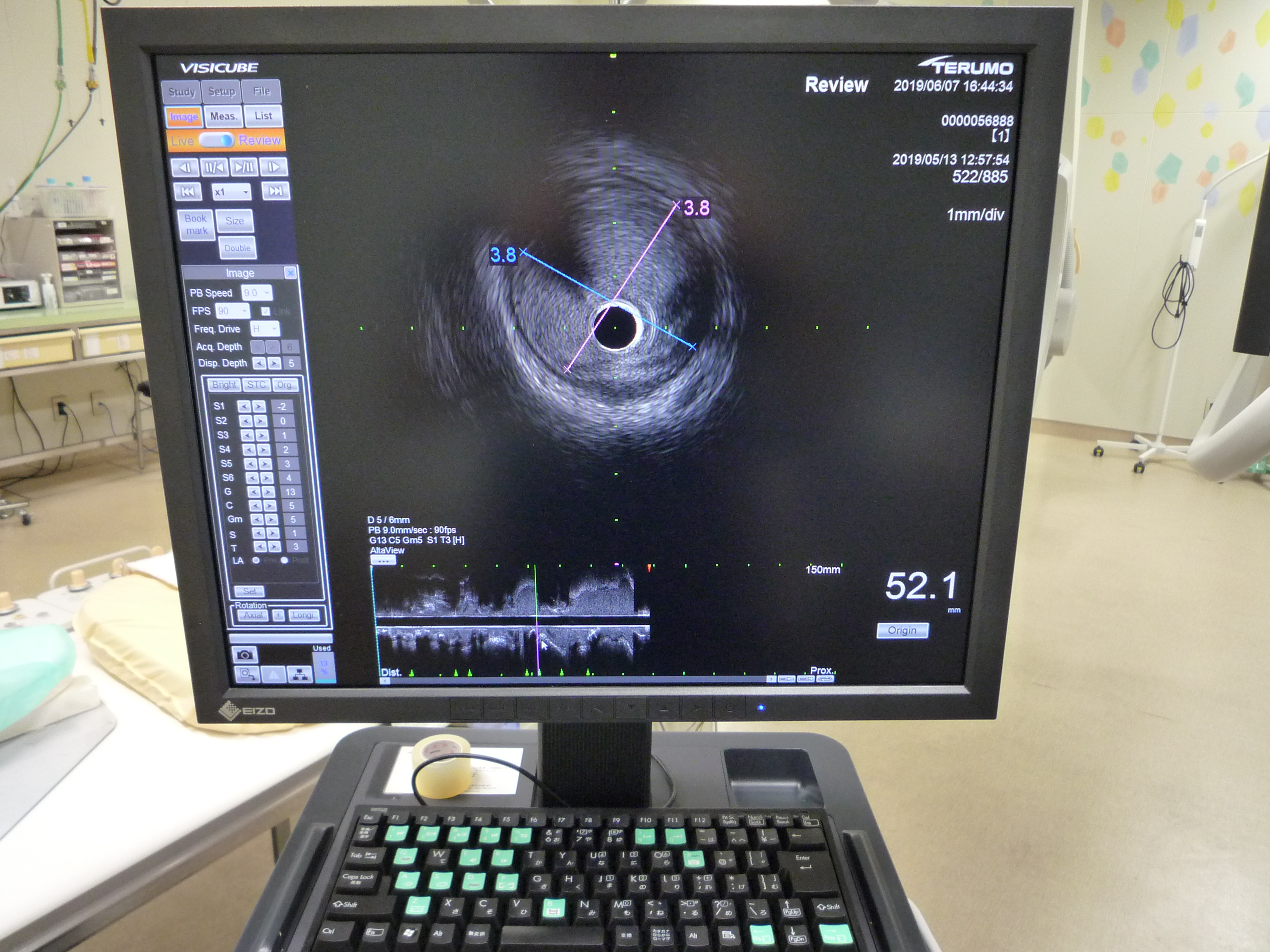 ＩＶＵＳ