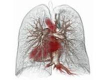 胸部血管３D