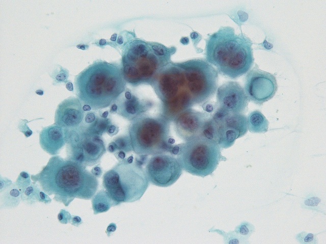 細胞診断