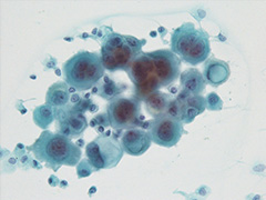 細胞診断イメージ1