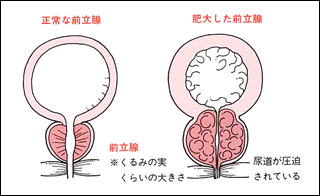 前立腺の図